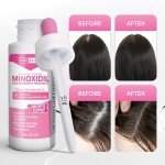 Hair-Regen Advanced 2% Minoxidil For Women, Hair Regrowth Treatment for Thinning Hair, Hair Loss for Women,6 Month Supply, Minoxidil Topical Solution for Thicker Fuller Hair