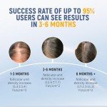 Laser Comb for Hair Growth, Red Light Therapy for Hair Growth, Laser Hair Growth Device Medical Grade Lasers, Stimulates Hair Growth, Reverses Thinning