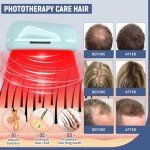 Laser Comb for Hair Growth, Red Light Therapy for Hair Growth, Laser Hair Growth Device Medical Grade Lasers, Stimulates Hair Growth, Reverses Thinning