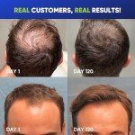 Svvimer Hair Growth Shampoo for Men - Biotin Thickening Shampoo with Rosemary Tea Tree Oil Caffeine for Hair Loss and Thinning Hair - 13.5 Fl Oz (Pack of 1)