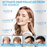 Hair Growth Device, 678nm Red Light Therapy System, Suitable for Thinning Hair, Hair Loss Treatment, Scalp Health Restoration, etc. for Men and Women. Wireless, Hands-free Hair Growth Helmet