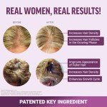 FORCE FACTOR Hair Growth Accelerator Soft Chews, Lustriva & Biotin to Promote Thicker, Stronger, Fuller Hair, Hair Growth Vitamins for Women, Clinically Studied, Mixed Berry, 60 Soft Chews