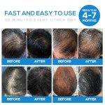 Tkcsoi Laser Hair Growth Cap，Laser Hair Growth Cap is Low Level Laser Therapy (LLLT) Devices That Promote Hair Growth in Women and Men
