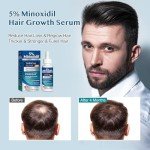 Minoxidil for Men Hair Growth Serum: Minoxidil for Women Hair Growth, Minoxidil 5 Percent for Men Hair Beard Regrowth Treatment - Hair Growth Oil for Stronger Thicker Longer Hair - 2OZ