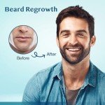 Minoxidil for Men Hair Growth Serum: Minoxidil for Women Hair Growth, Minoxidil 5 Percent for Men Hair Beard Regrowth Treatment - Hair Growth Oil for Stronger Thicker Longer Hair - 2OZ