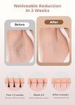 Hikyskin Laser Hair Removal with Cleaning Lamp, Ice-Cooling IPL Hair Removal Device for Men and Women, Safe Long-Lasting At Home Hair Remover Device for Face Back Leg Arm Whole Body