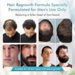 Minoxidil for Men Hair Growth Spray - 5% Topical Hair Regrowth Treatment for Thinning Hair and Beard Growth, Extra Strength Hair Loss Solution, 1-Month Supply, 2 Fl Oz (Pack of 1)