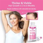 Minoxidil For Women 2% Hair Regrowth Treatment for Women, 1-Month Supply, Unscented, 2 fl oz