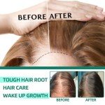 Yaopin Anti-Hair Loss and Hair Growth Solution, Beautykomi Anti-Hair Ioss Hair Care Liquid, Yao Products Anti-Hair Loss Hair Conditioner, Herbal Hair Care Serum 30ml/1.05oz