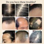 Yaopin Anti-Hair Loss and Hair Growth Solution, Beautykomi Anti-Hair Ioss Hair Care Liquid, Yao Products Anti-Hair Loss Hair Conditioner, Herbal Hair Care Serum 30ml/1.05oz