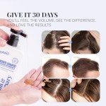 Biotin & Rosemary Shampoo for Hair Growth: Hair Loss Shampoo for Thinning Hair Infused with Natural Nutrient Rich Ingredients for Hair thickening Sulfate Free 10 fl oz