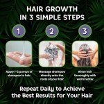 Rosemary & Biotin Hair Growth Shampoo for Women & Men, Natural Thickening & Regrowth Formula, Tea Tree Mint Strengthening Shampoo with Castor Oil - For Thinning Hair, Hair Loss, All Hair Types 10.1 Oz