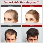Laser Hair Growth Cap,Red Light Therapy Cap TW147,Laser Hair Growth System Hair Loss Treatments for Men and Women,Hair Regrowth Treatments Laser Cap (White)