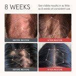 iRestore Anti Hair Loss and Thinning Shampoo - Biotin Formula for Hair Growth, Thickening and Volumizing for Men & Women