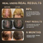 Laser Hair Growth Comb - Laser Light Therapy for Hair Growth, Handheld Scalp Laser Device for Thicker, Healthier Hair