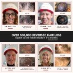 iRestore Professional + Rechargeable Battery Pack - Laser Red Light Therapy for Hair Growth - FDA Cleared Hair Loss, Thinning Treatment for Men & Women - Hair Regrowth Cap - 282 Lasers & LEDs