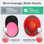 iRestore Professional + Rechargeable Battery Pack - Laser Red Light Therapy for Hair Growth - FDA Cleared Hair Loss, Thinning Treatment for Men & Women - Hair Regrowth Cap - 282 Lasers & LEDs