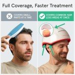 iRestore Professional + Rechargeable Battery Pack - Laser Red Light Therapy for Hair Growth - FDA Cleared Hair Loss, Thinning Treatment for Men & Women - Hair Regrowth Cap - 282 Lasers & LEDs