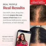 HAIRtamin Advanced Formula Hair Vitamins for Women & Men | Vegan 5000 Mcg Biotin Capsules Vitamin Supplement | Hair Skin and Nail Capsule Supplement to Promote Hair Growth & Thickness | 30 Count