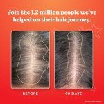 HAIRtamin Advanced Formula Hair Vitamins for Women & Men | Vegan 5000 Mcg Biotin Capsules Vitamin Supplement | Hair Skin and Nail Capsule Supplement to Promote Hair Growth & Thickness | 30 Count