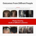 Laser Cap, Red Light Therapy for Hair Growth,Hair Loss Treatments Hat for Men & Women,Laser Red Light Therapy Hair Regrowth with Built-in Battery & Controller