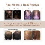 iHelmet Laser Hair Growth System (FDA Cleared), Hair Regrowth Helmet & Laser Cap, Hair Loss Treatment for Men and Women, Low Level Laser Therapy for Hair Growth, Anti-Thining Treatment，36 Pink