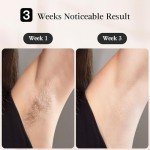 JOVS Laser Hair Removal, [24J Energy] IPL Hair Removal for Women and Men, 37°F Painless Sapphire Ice-Cooling Tech, 6 Modes for Whole Body Hair Removal Device, 2 in 1 Skin Rejuvenation, 330° Rotation