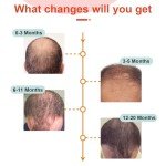 WEILASER Laser Cap for Hair Regrowth, Laser Hair Growth Cap, Black