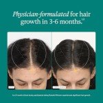 Nutrafol Women’s Hair Loss Supplement with Synergen Complex