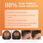 BosRevive Volumizing Conditioner for Thinning, Color/Chemically-Treated Hair – DHT Blocker, Sulfate-Free, Vegan, Biotin, Saw Palmetto & Rosemary – Thicker, Fuller Hair – 33.8 Fl Oz.