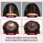 Hair Growth Shampoo for Thinning Hair: Advanced Biotin and Rosemary Shampoo with Rice Water for Women and Men Hair Loss - Herbal Essences Promotes Hair Root Activator, 10.5 Fl Oz