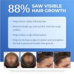 BosRevive Nourishing Shampoo for Noticeably Thinning, Non Color-Treated Hair – Helps Restore Thinning Hair & Remove DHT, Product & Pollution Build-Up, Boosts Scalp Circulation, Sulfate-Free 33.8 Fl Oz