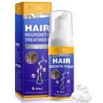 5% Minoxidil Foam for Hair Growth and Thickening - Biotin & Minoxidil Treatment to Stop Thinning & Hair Loss for Men & Women, 2oz