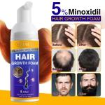 5% Minoxidil Foam for Hair Growth and Thickening - Biotin & Minoxidil Treatment to Stop Thinning & Hair Loss for Men & Women, 2oz