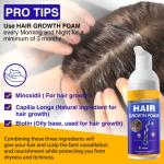 5% Minoxidil Foam for Hair Growth and Thickening - Biotin & Minoxidil Treatment to Stop Thinning & Hair Loss for Men & Women, 2oz