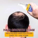 5% Minoxidil Foam for Hair Growth and Thickening - Biotin & Minoxidil Treatment to Stop Thinning & Hair Loss for Men & Women, 2oz