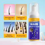 5% Minoxidil Foam for Hair Growth and Thickening - Biotin & Minoxidil Treatment to Stop Thinning & Hair Loss for Men & Women, 2oz