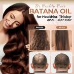 Dr. Healdy Batana Oil Shampoo and Conditioner Set - for Hair Growth,Thickening & Hydration,Sulfate Free - Fights Hair Loss & Clarifies Scalp - for Men & Women (6.8 Fl Oz×2)