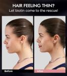 Tripeptide-Infused Hair Growth Biotin Shampoo and Conditioner Set, Onion Anti-Loss Volumizing Moisturizing Treatment for Soft Shine Hair, Rosemary Clarifying Dandruff Shampoo for Women Men, 2 x 16.9oz