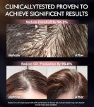 Tripeptide-Infused Hair Growth Biotin Shampoo and Conditioner Set, Onion Anti-Loss Volumizing Moisturizing Treatment for Soft Shine Hair, Rosemary Clarifying Dandruff Shampoo for Women Men, 2 x 16.9oz