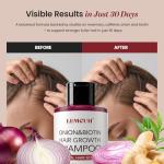 Onion & Biotin Hair Growth Shampoo: Infused With Natural Rosemary Tea Tree Anti Hair Loss Shampoo - Scalp Smooths Thickening Formula Support Hair Regrowth For Women Men 12.5Fl Oz