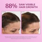 BosleyMD Minoxidil Woman Spray, Thinning Treatment/Hairspray for Hair Loss and Hair Regrowth, Topical Solution, No Mess Sprayer, 2-month Supply