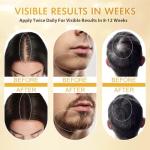 ZYXN Minoxidil for Men and Women, Hair Growth Biotin Serum with Batana and Rosemary for Hair Beard Regrowth Treatments Extra Strength Hair Loss Solution, Clinically Proven to Regrow Thicker