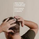 Keeps Extra Strength Minoxidil for Men - 5% Minoxidil Foam Hair Loss & Regrowth Treatment for Thinning & Bald Spots - Clinically Proven Hair Growth Products - Unscented Topical Aerosol Foam