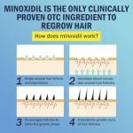 Ruahouine 5% Minoxidil Foam for Hair Regrowth, Topical Hair Loss Treatment for Men to Regrow Fuller, Thicker Hair, Rosemary Minoxidil Topical Aerosol, 60ml / 2.11oz