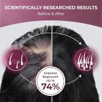 PUREHEALTH RESEARCH ReGrow - Hair Growth Vitamins - with Saw Palmetto, Biotin, Collagen, Zinc, Iron, Iodine, Selenium & More - Hair Supplements for Women & Men - 60 Capsules