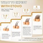 5% Minoxidil for Women Hair Growth Serum Topical Minoxidil Hair Regrowth Thicker Prevent Hair Loss for Thickening Longer Fuller Healthier Hair 3 Bottles of 2oz