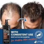 Root Activator Shampoo for Men: Hair Growth Shampoo for Hair Loss and Thinning Hair - 10.1 fl oz / 300 mL