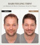 99% Pure Biotin Shampoo for 3X Thicker, Fuller Hair Growth, 80% Less Hair Loss w/Thuja Extract, Batana & Noni Fruit Oil Hair Care for Deep Nourishing,Rosemary Dandruff Treatment for Men Women,11.83oz