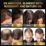 Minoxidil for Men & Women, With Biotin, Batana Oil, Rosemary Essential Oil, Effective Hair Loss Solution, Hair Loss Treatment for Hair Regrowth, Non-Greasy 5% Minoxidil - 60ml